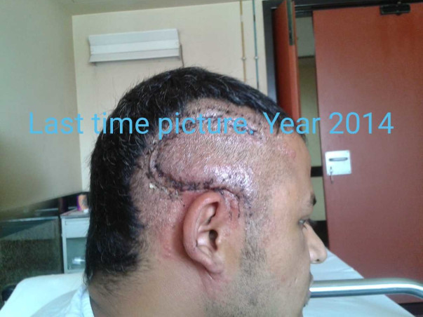 Help Me Fight Brain Tumor