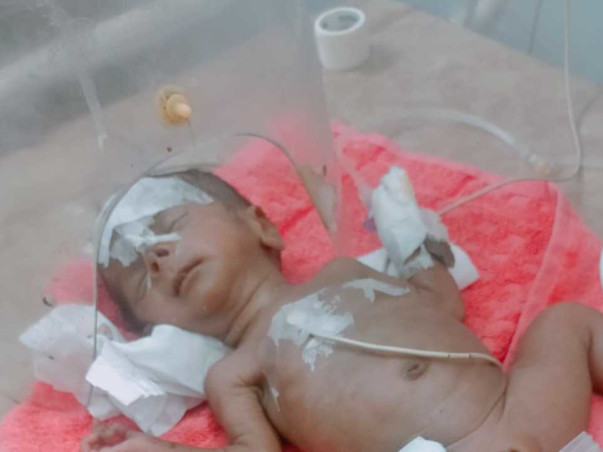 Support Baby of Deepa To Recover From Preterm Birth