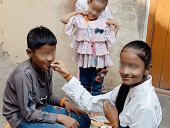 His Sister Is Waiting For Him To Tie Rakhi. But He Needs Support Even To Survive Till Raksha Bandhan