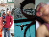 A Portion Of The Roof Fell On My Husband's Head While We Were All Sleeping... Help Me Save Him!