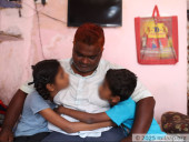 She Tolerated The Polio... But When I Got Cancer, My Wife Abandoned Me!