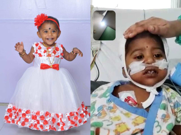 2 Years Old Priyasree Aishwarya Mungara Needs Your Help To Recover From Chronic Kidney Disease