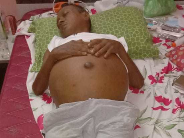 Help My Brother Fight Liver Transplantation