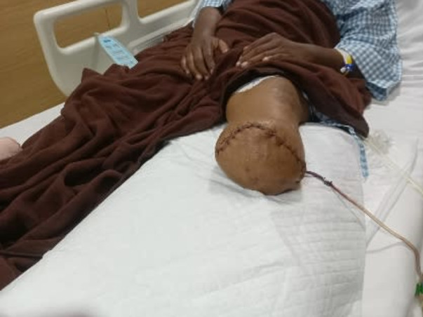 Help My Uncle To Recover From Gangrene