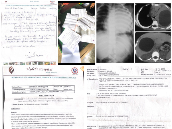 Support Manirul Islam Recover From Lungs Infection