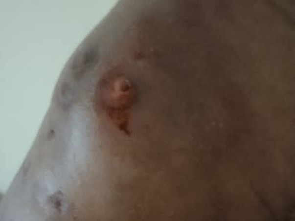 Help To Get Rid Of  Lymphedema And Cardiac Problem