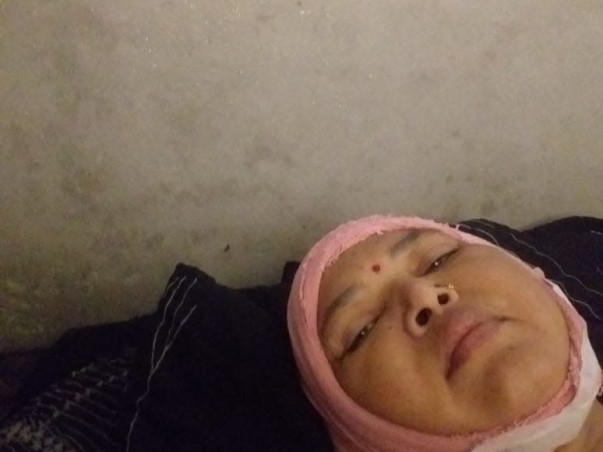 Support Munni Devi To Recover From Brain Tumor