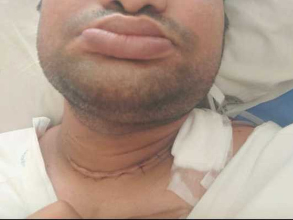 Support Dipanjan Basu Fighting With Thyroid Cancer and Kidney disease.