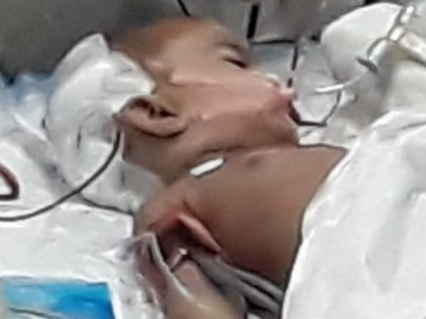 Support Azra Fathima(1 Year Old) Recover From Brain Cancer