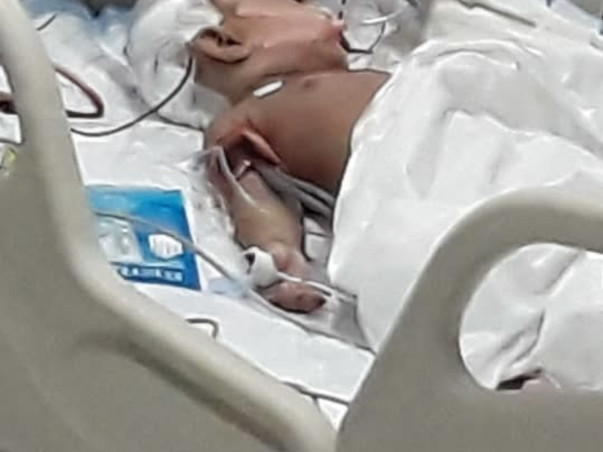 Support Azra Fathima(1 Year Old) Recover From Brain Cancer