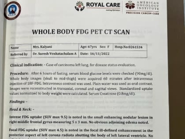Please help my wife Kalyani fight Non small cell lung cancer