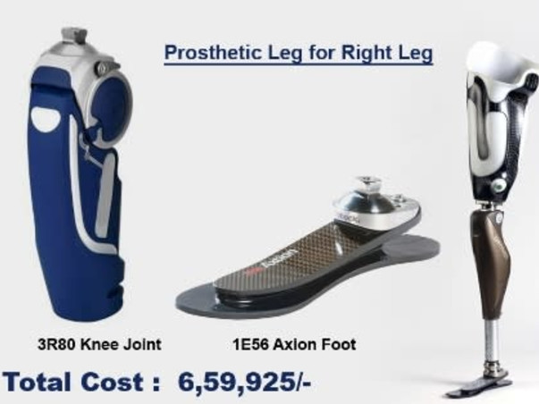 Irsath 36/M  needs your help struggle for Prosthetic Leg