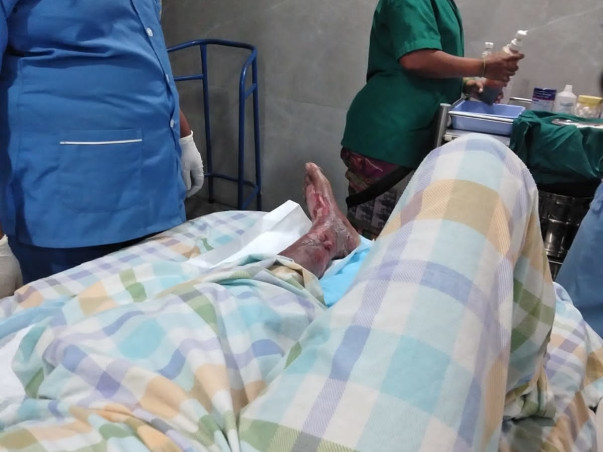 Support Bramarabha Recover From Cellulitis