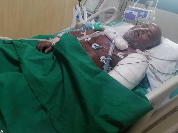 Support Thambi Annan Recover From Accidental Multiple Injuries