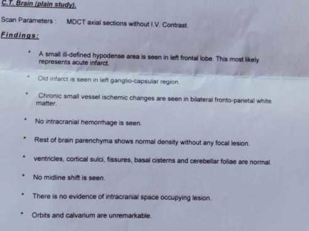 Support Giri Gopal Recover from Paralysis