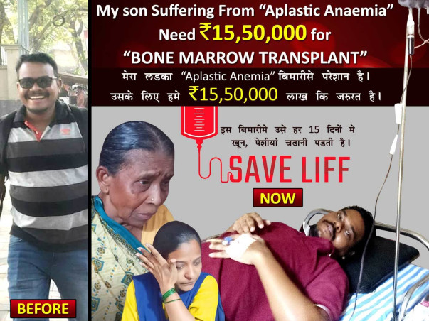 My Husband Is Suffering From Aplastic Anemia Please Support Us.
