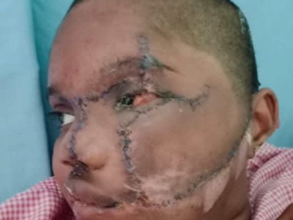 #SupportAnushaUndergoPlasticSurgery