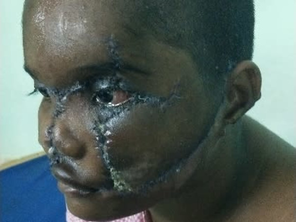 #SupportAnushaUndergoPlasticSurgery