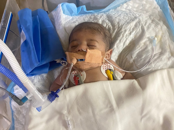 Support Affan Zayn Recover From Maple Syrup Urine Disease