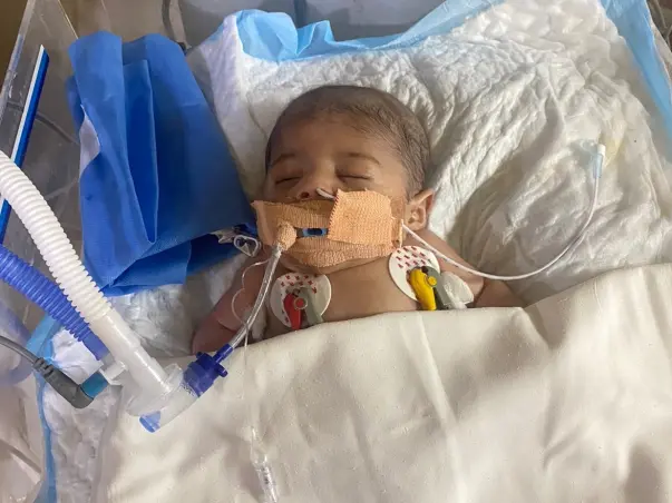 Support Affan Zayn Recover From Maple Syrup Urine Disease