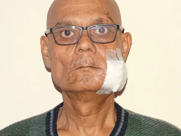 Help Mr. Samuel Fight Oral Cancer.