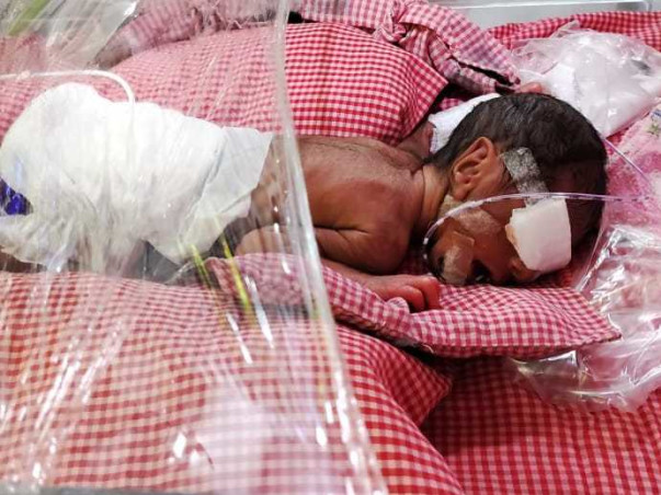 Support Twin Babies Of Moni Tiwari To Recover From Preterm Twins With