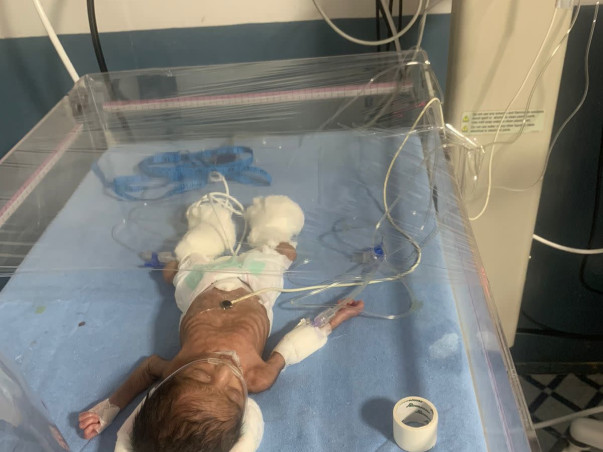 Help My Daughter To Recover From Preterm Complication Blood infection