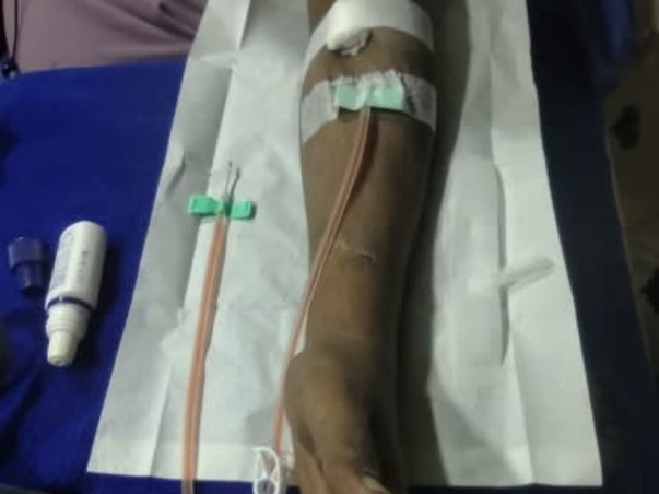 Help Save My Husband Prodipan's Life Through Kidney Transplant.