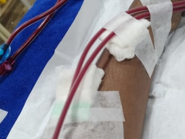 Help Save My Husband Prodipan's Life Through Kidney Transplant.