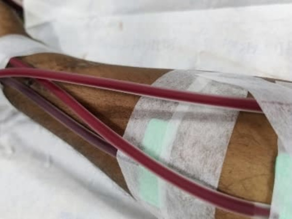 Help Save My Husband Prodipan's Life Through Kidney Transplant.