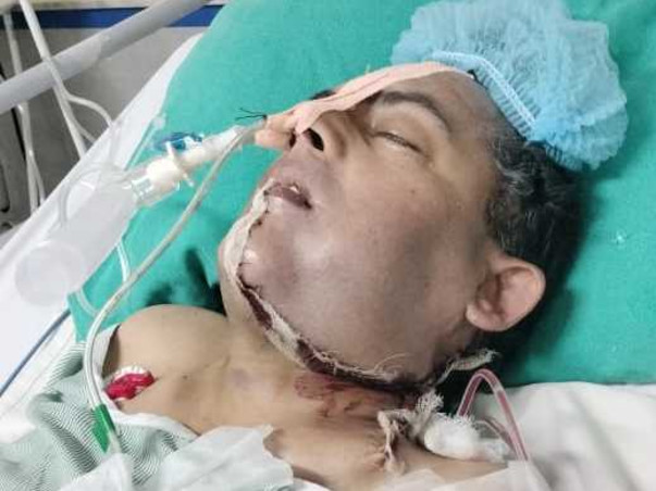 Help Rajesh Verma recover from Oral Cancer