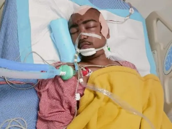 Help My Brother To Recover From Accidental Brain Injury