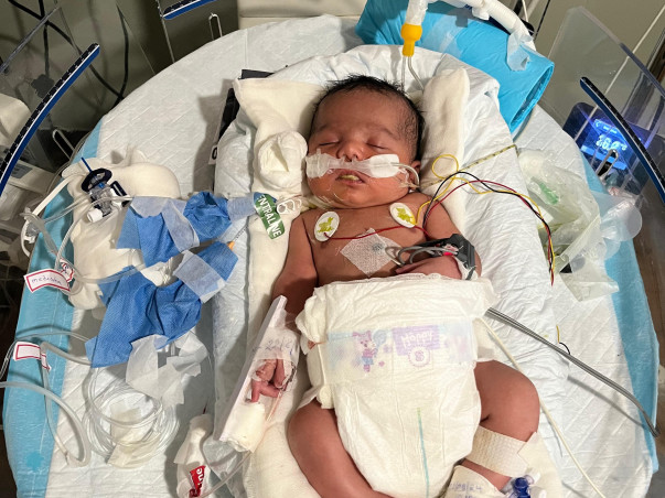 Support Baby of D Varalakshmi To Recover From Severe Birth Complications