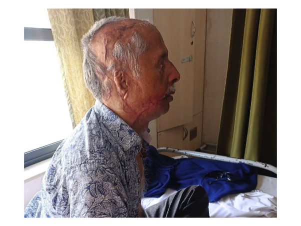 Support Dinesh's Surgery to Recover from a Devastating Acid Attack