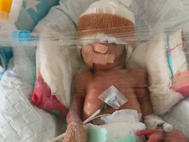 Tiny Fighter Help Baby of Shruti Maheshwari Born at twentyseventh week