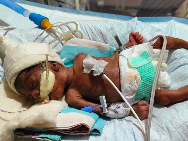 Tiny Fighter Help Baby of Shruti Maheshwari Born at twentyseventh week
