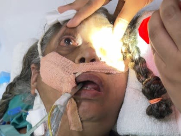 Support Savi To Recover from Hypoxic Brain Injury & Respiratory Failur