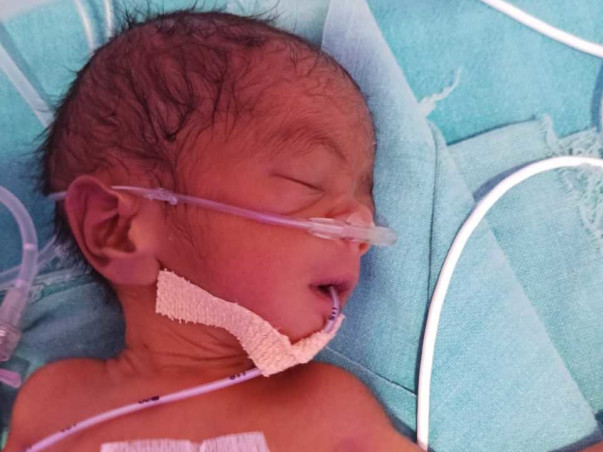Support Baby Of Nirmala Kullu To Recover From Preterm Birth Complication