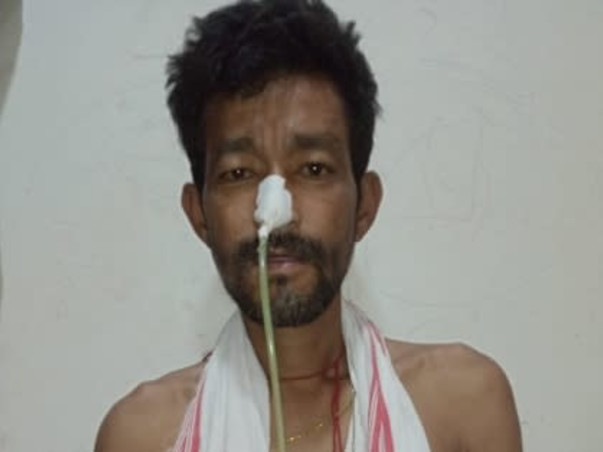 Support Amal Swarigiary To Recover From Esophageal Cancer
