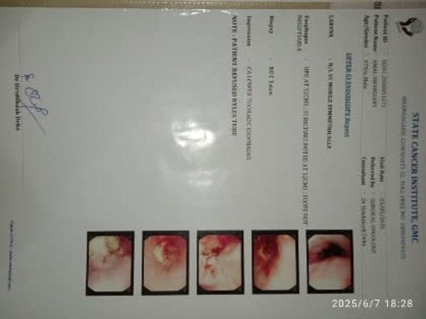Support Amal Swarigiary To Recover From Esophageal Cancer