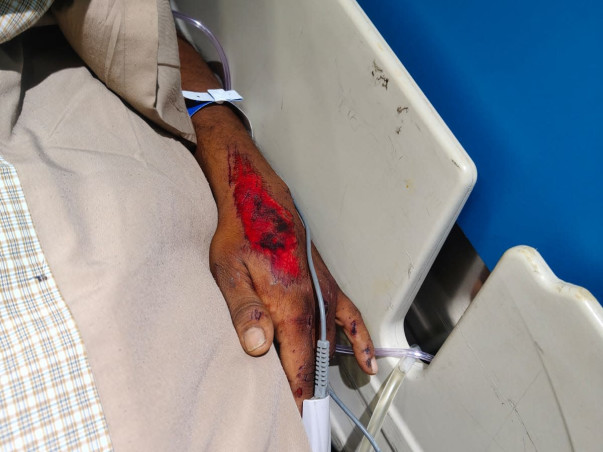 Help Bappaditya Fight for His Life After a Devastating Accident