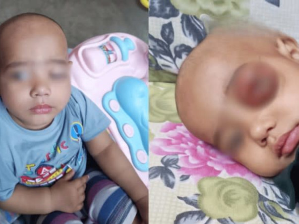 Support My Son To Recover From Neuroblastoma