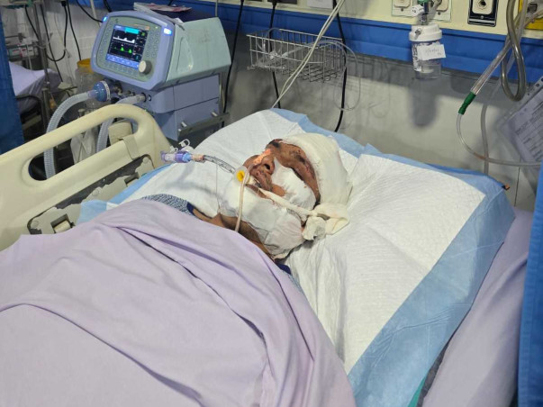 Help My Son Recover from a Severe Brain Injury After an Accident
