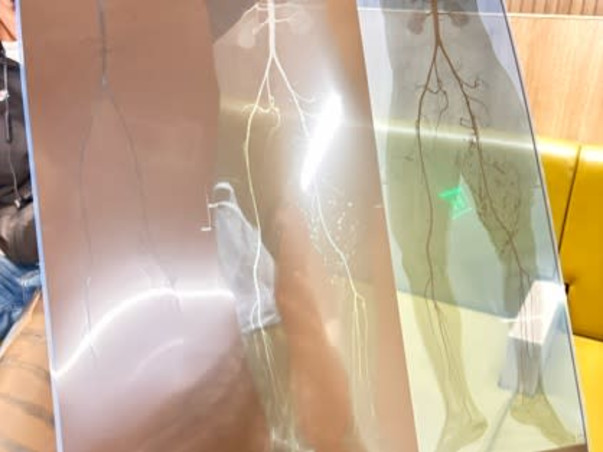 Help Vishvanath Recover After a Major Accident and Multiple Surgeries