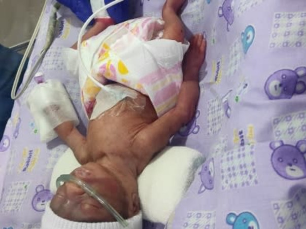 7 day Old Babies (twins baby boy) Of Sayeta Needs Your Help To Recover