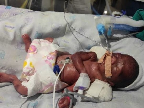 7 day Old Babies (twins baby boy) Of Sayeta Needs Your Help To Recover