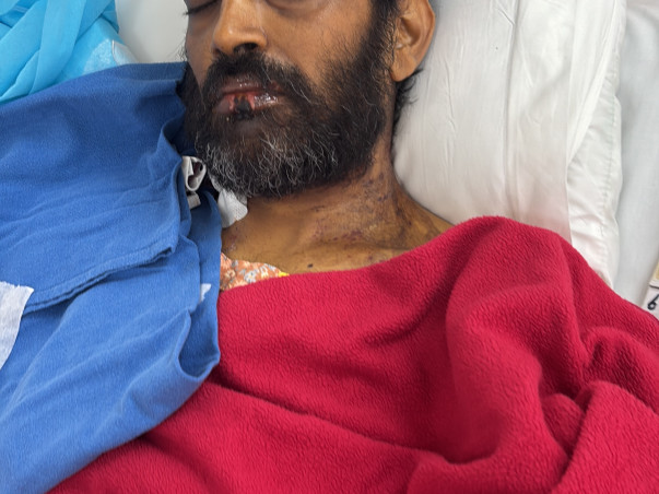 Support Satinder Hooda To Recover From Multiple Organ Failure