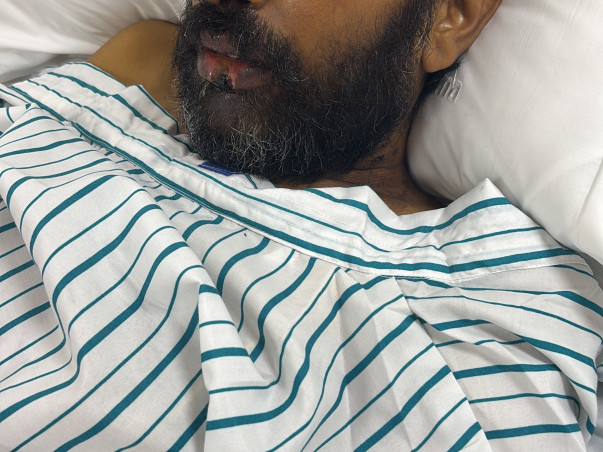 Support Satinder Hooda To Recover From Multiple Organ Failure