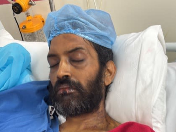 Support Satinder Hooda To Recover From Multiple Organ Failure