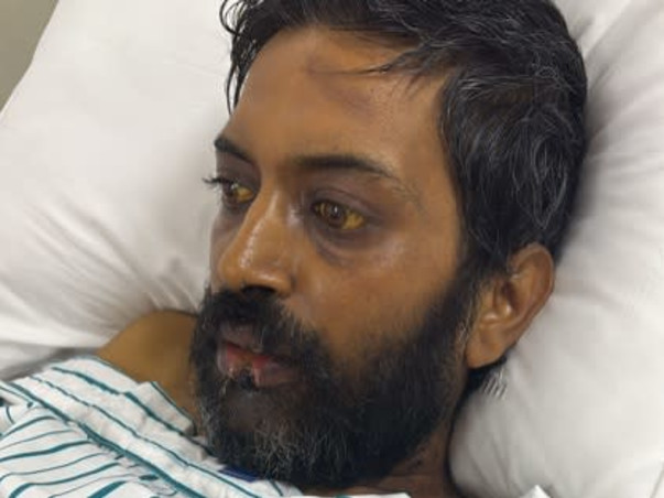 Support Satinder Hooda To Recover From Multiple Organ Failure